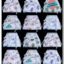 Kids Need Premium langots for new born 0-6 months (12 Pack) Super Soft Double Layered nappy Breathable cotton cloth nappies for new born baby essentials | NP2
